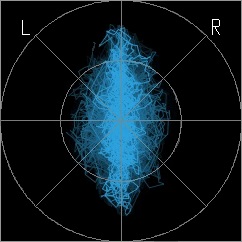 Goniometer